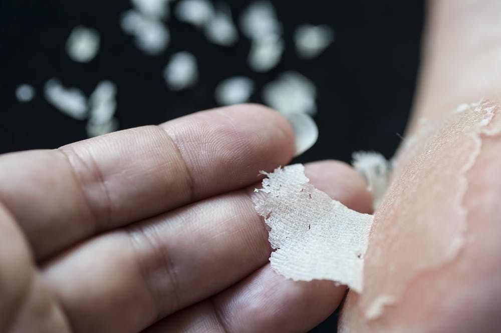 Why Do My Feet Keep Peeling Brit Co