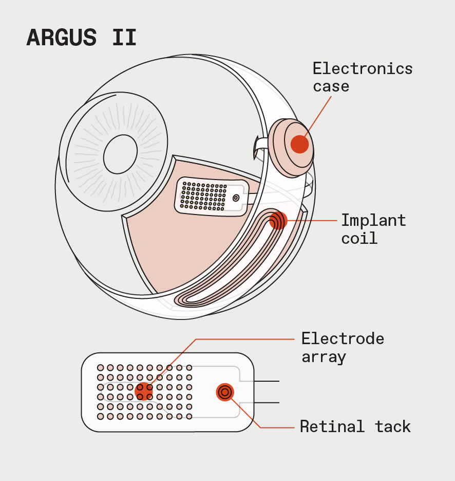 argus 2 price