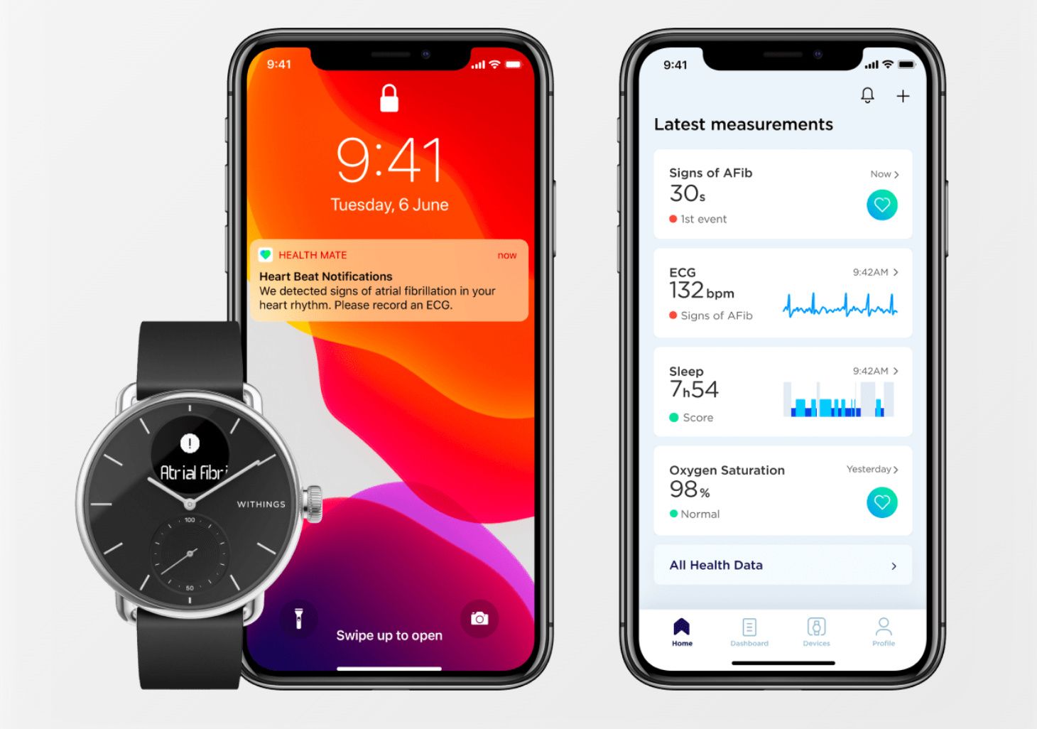 Withings App - iOS - Withings Apple Watch app – Withings