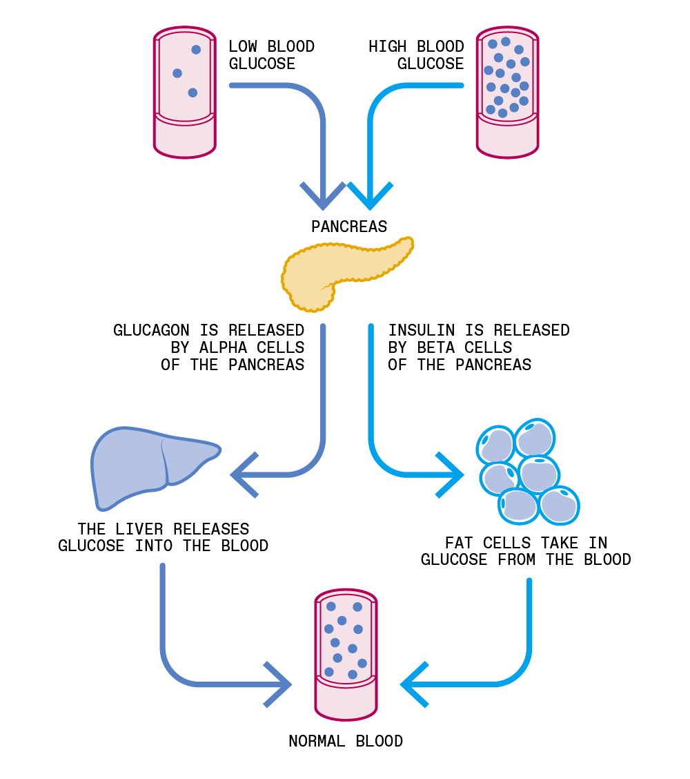 A Smart Artificial Pancreas Could Conquer Diabetes   IEEE Spectrum