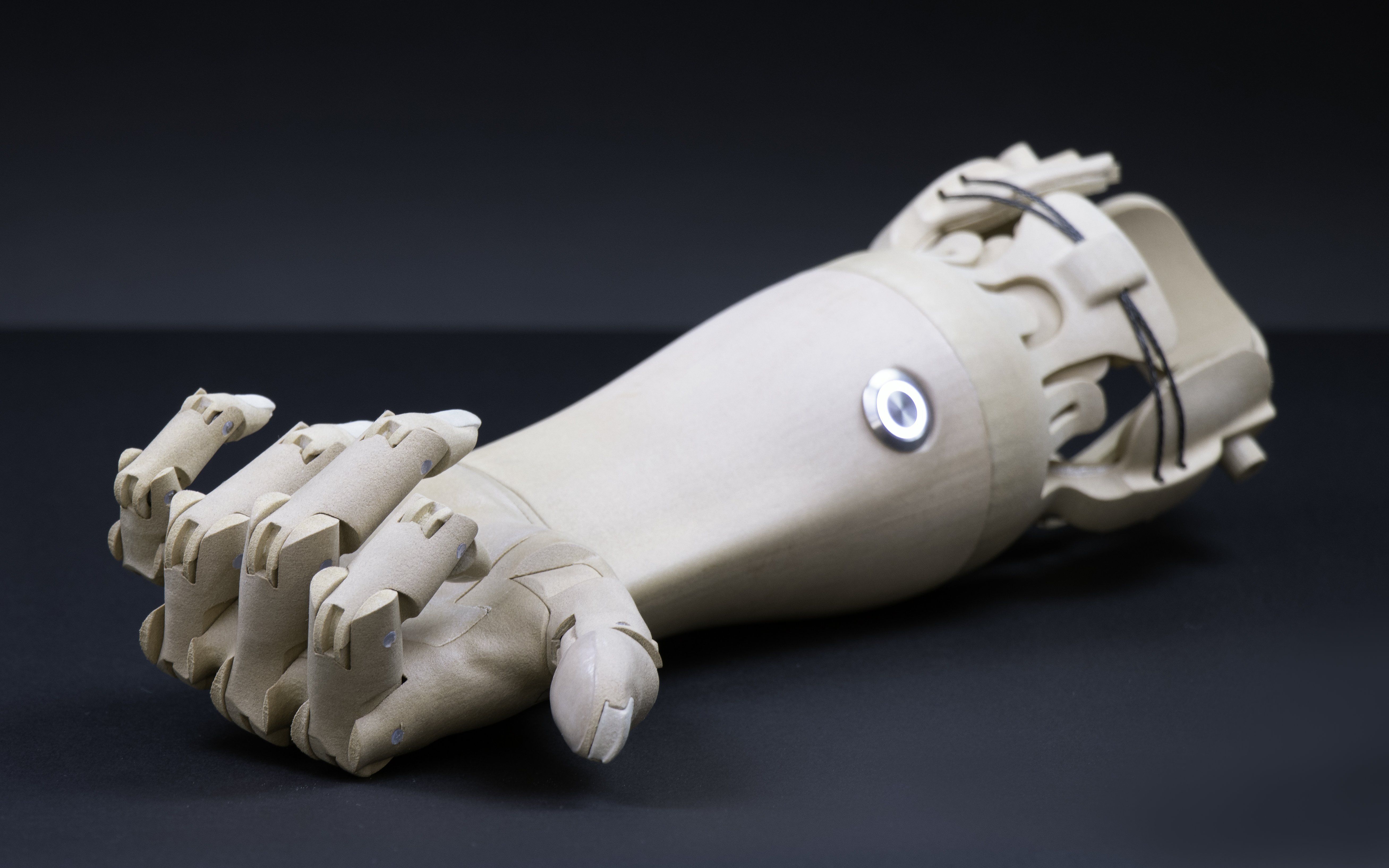 3d Printed Hand Prosthetic