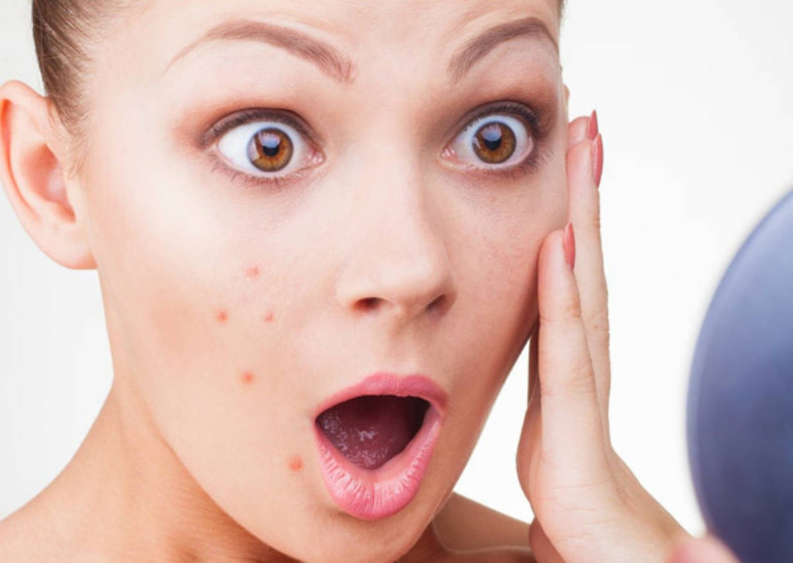 diet for pimple and acne