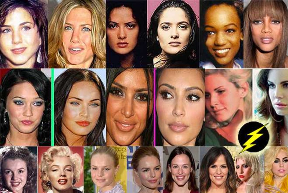 Best Plastic Surgery Makeovers—Or Just 'Natural' Transformations (Ha Ha!)