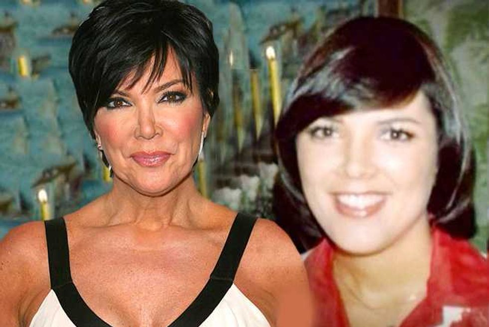 How Real Are The Kardashians? Kris Jenner Plastic Surgery Exegesis