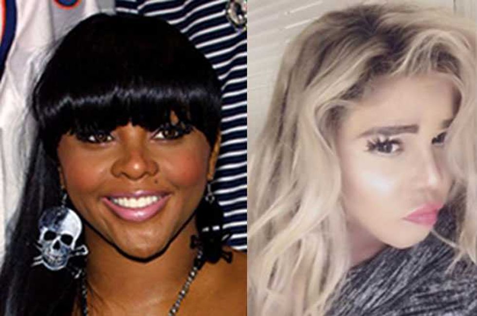 Lil Kim's New Face — Time For An Intervention?