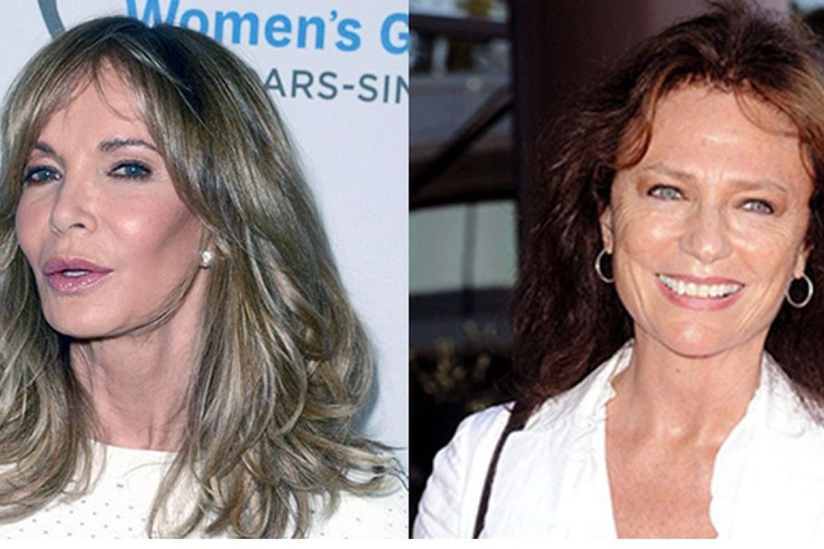 old actresses plastic surgery