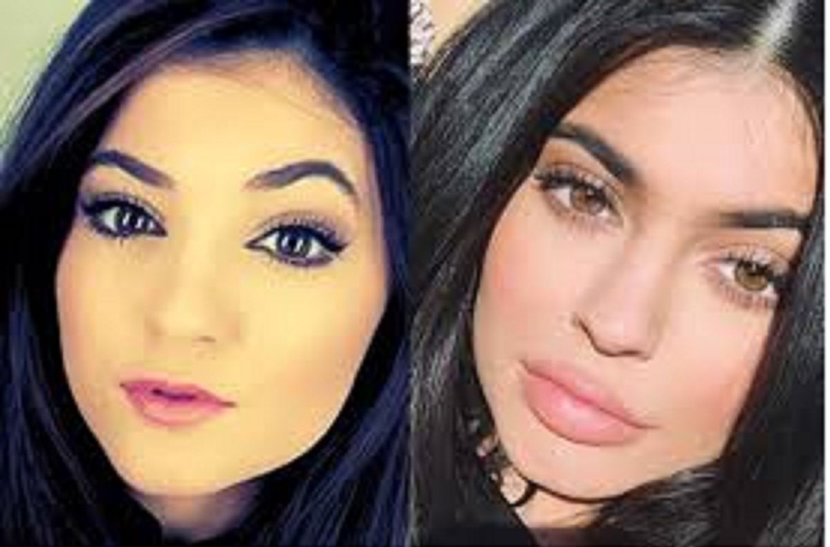 We Need to Talk About Kylie Jenner.