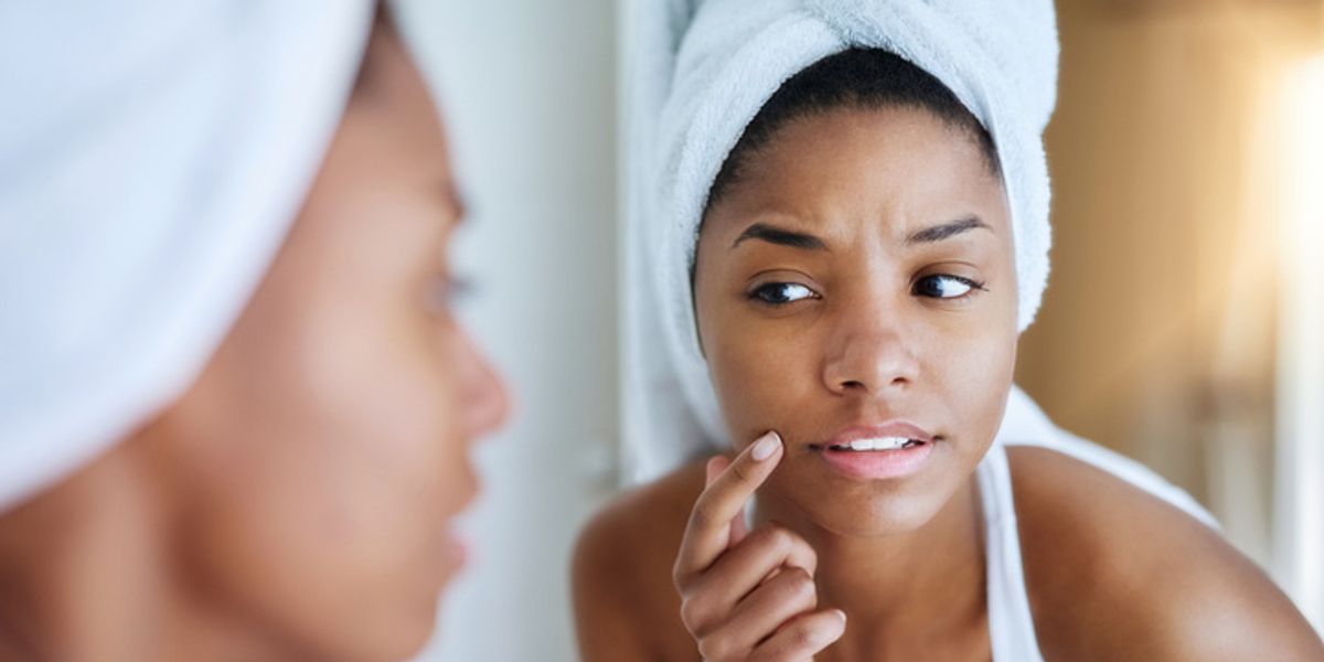 xoNecole Readers Share How They Get Rid Of Dark Spots