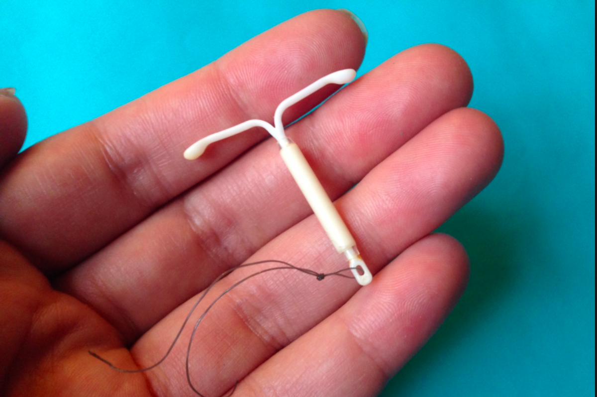 This Is What Happens When Getting The IUD Does Not Turn Out OK