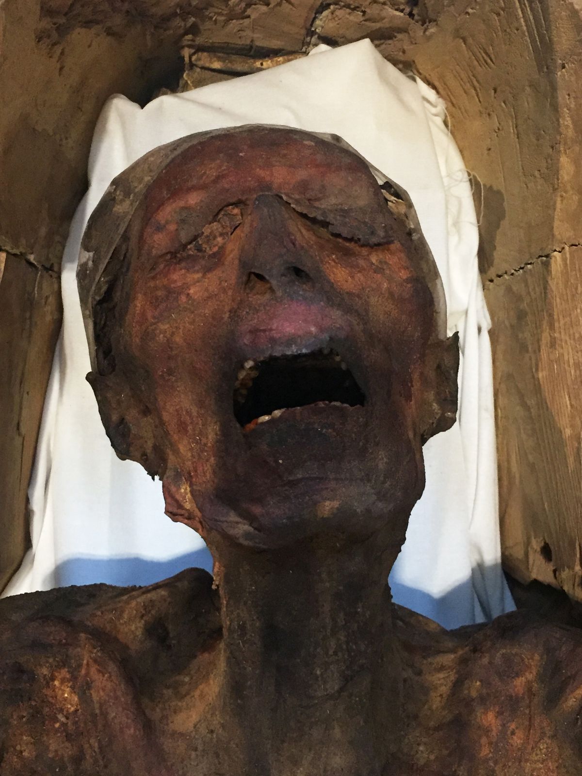 Archaeologists May Know Why 'The Screaming Mummy' Was In Agony During Death