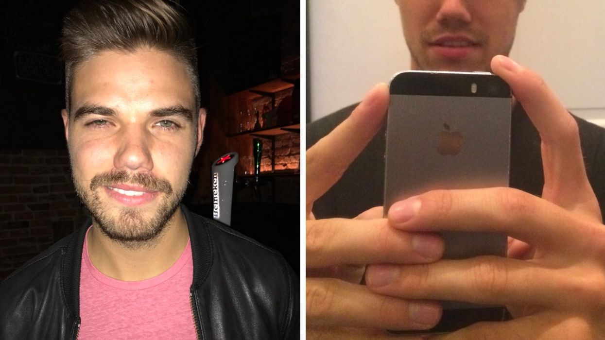 Swedish Student Learns The Hard Way That He's Very Allergic To Hair Dye 😮