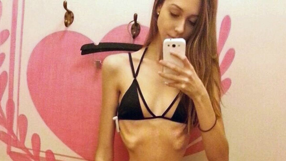Former Ballerina Reveals How Pressure To Be Thin Caused Her To Weigh Herself 30 Times A Day