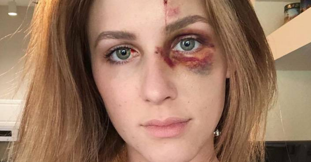 Woman's Message About Domestic Abuse Goes Viral When She Posts Pictures Of Her Assault On Instagram