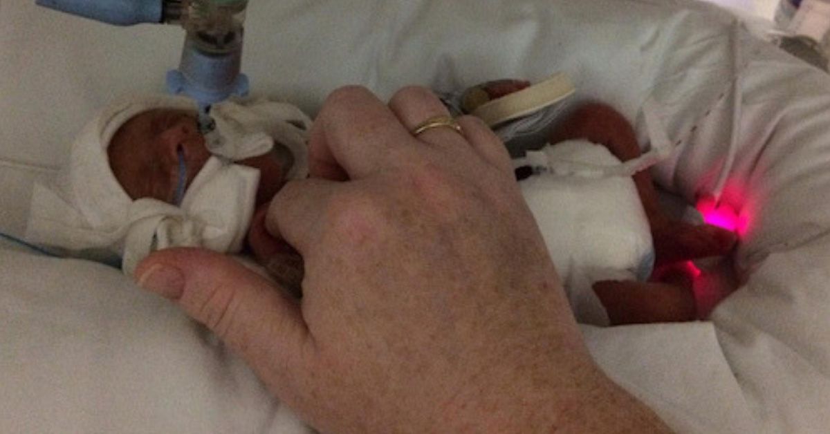 "Miracle" Baby Survives Being Born Almost Four Months Early At Just 1lb 4oz