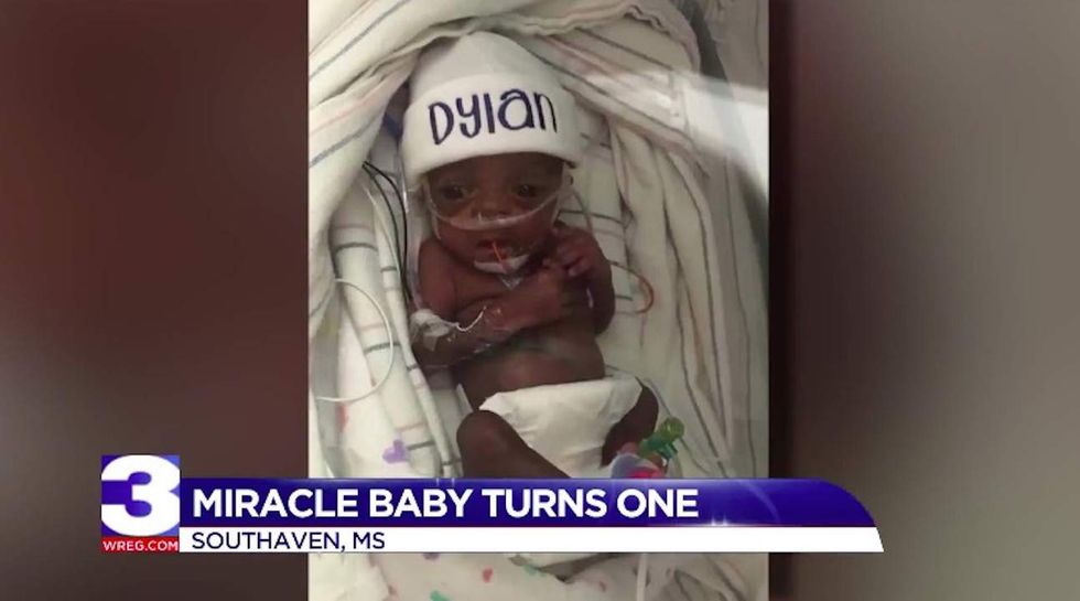 Baby Born Weighing Just 13 Ounces Celebrates His First Birthday TheBlaze baby-born-weighing-just-13-ounces-celebrates-his-first-birthday-theblaze