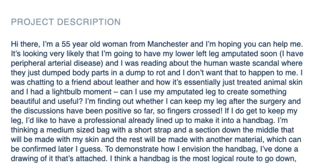 Amputee Posts Request For Handbag Design Using Flesh From Her Lost Leg