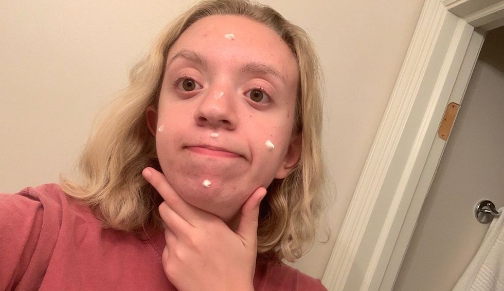 I Tried Personalized Acne Medicine For A Month, Here's What Went Down