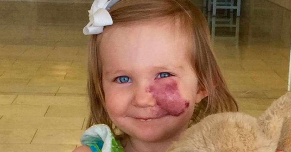 A 2-year-old saw people whispering about her birthmark and responded in the most adult way possible.