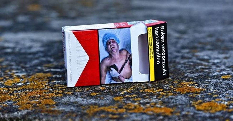 Man is furious after seeing a picture of his amputated leg on a tobacco warning label.
