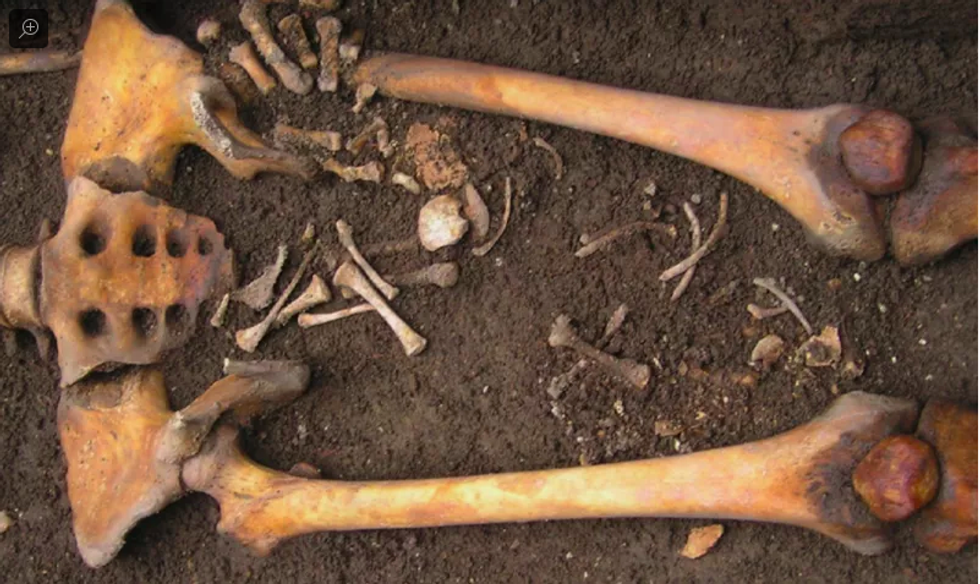 Mysterious Medieval Italian Skeleton Offers Unique Insight Into Ancient Medicine