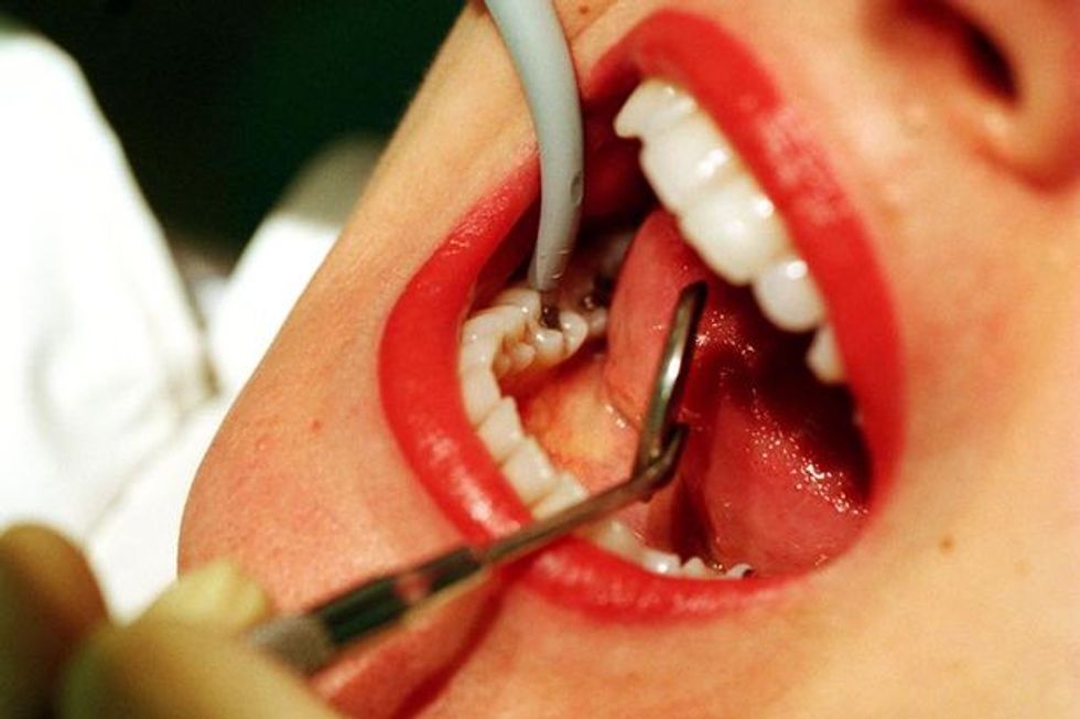 The Dentist’s Drill May Soon Become Obsolete