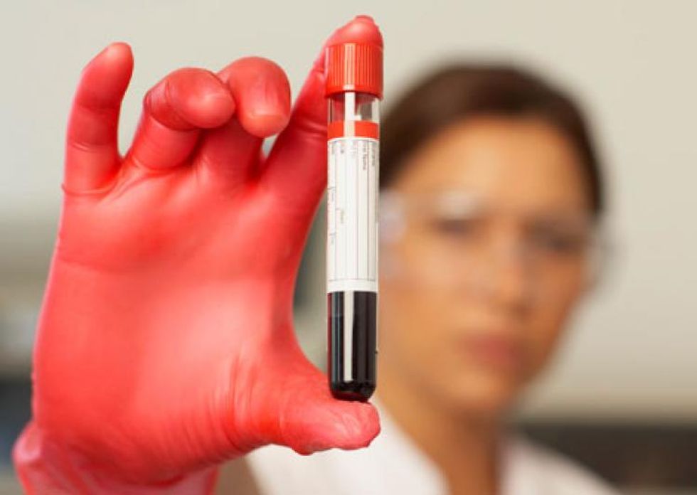 New Blood Test Detects Cancer Before Symptoms Start