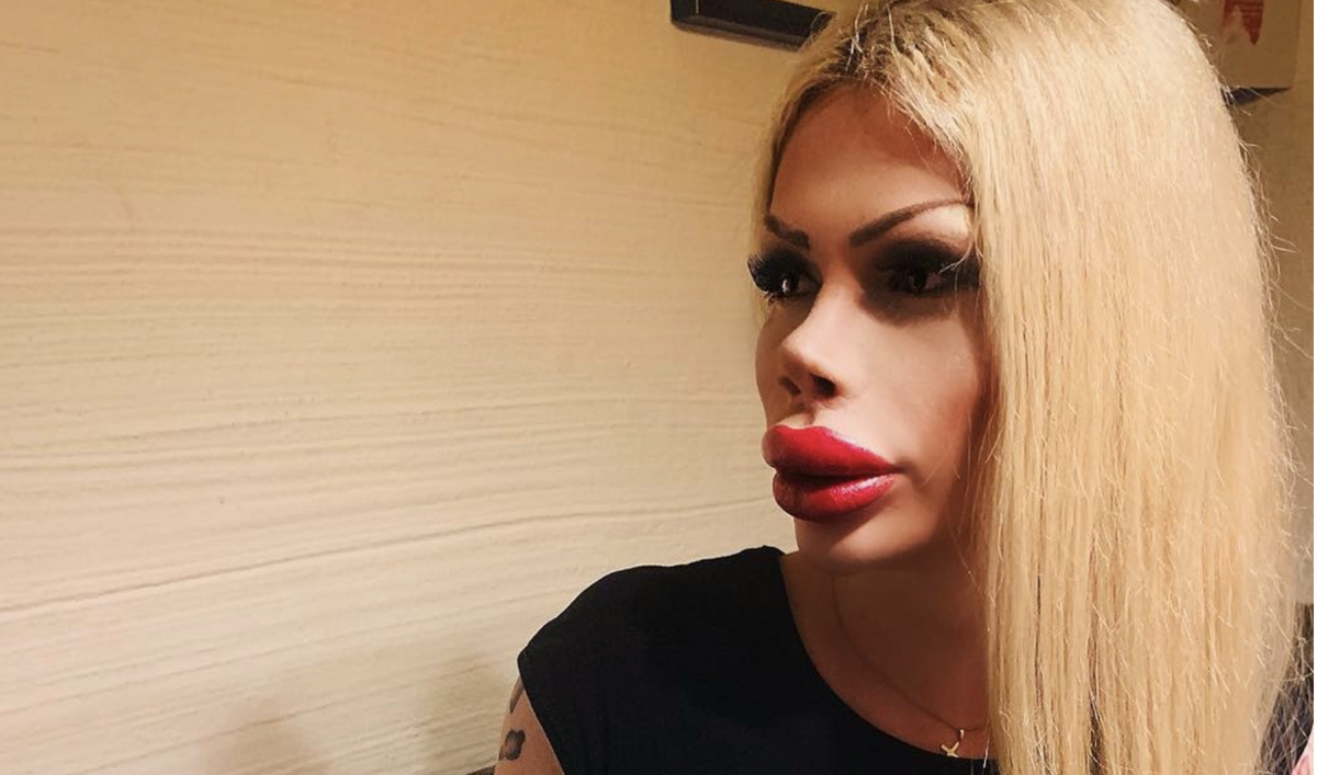 Gender-Neutral Student Who Spent Over $65,000 On Plastic Surgery To Look Like A Doll Hits Back At Critics