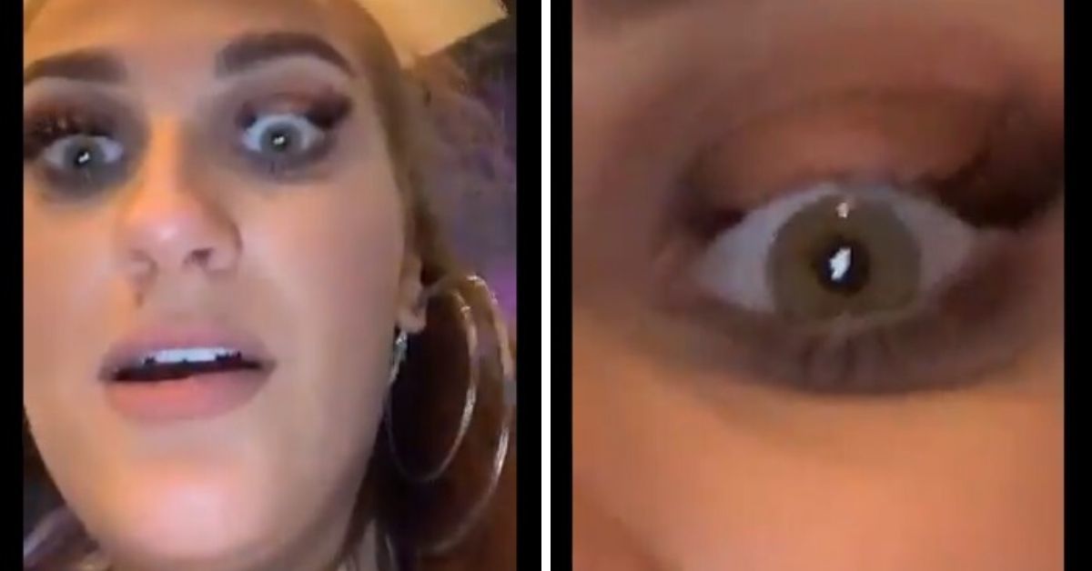 Girl Loses A Chunk Of Her Eyelashes After Whacking Herself In The Face With A Giant Adult Toy