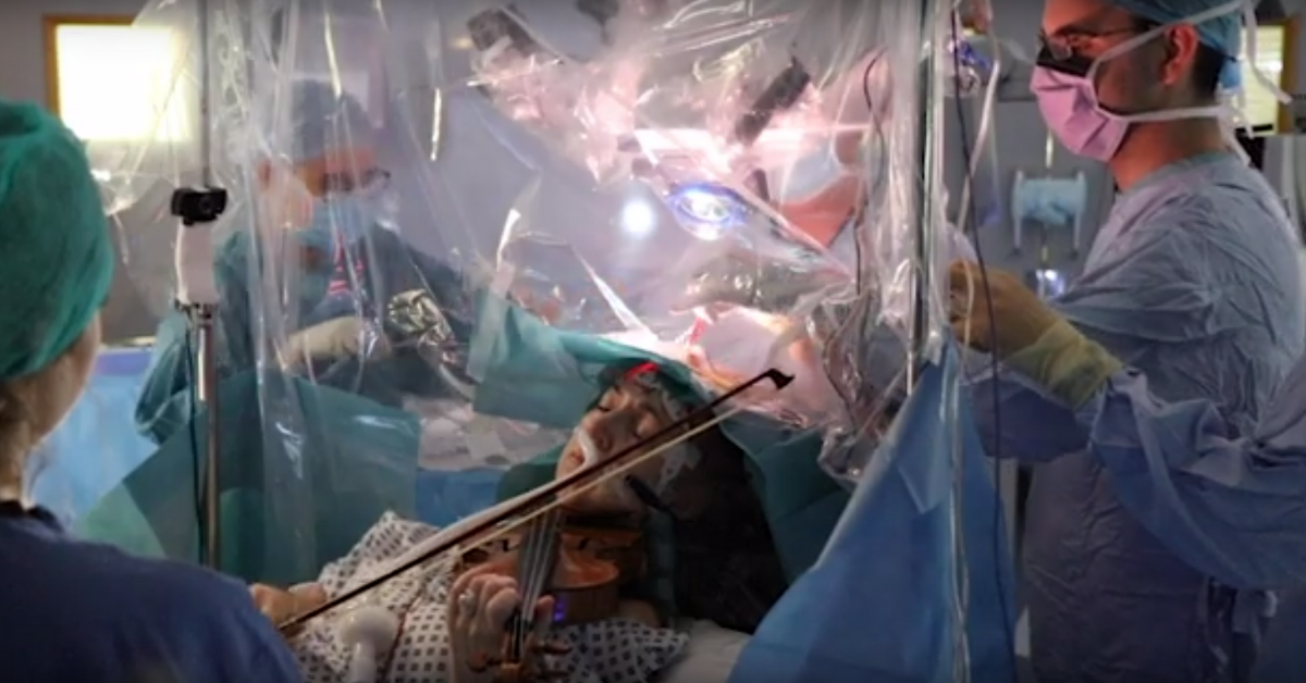 Woman Plays The Violin In Viral Video As Neurosurgeons Remove Tumor From Her Brain