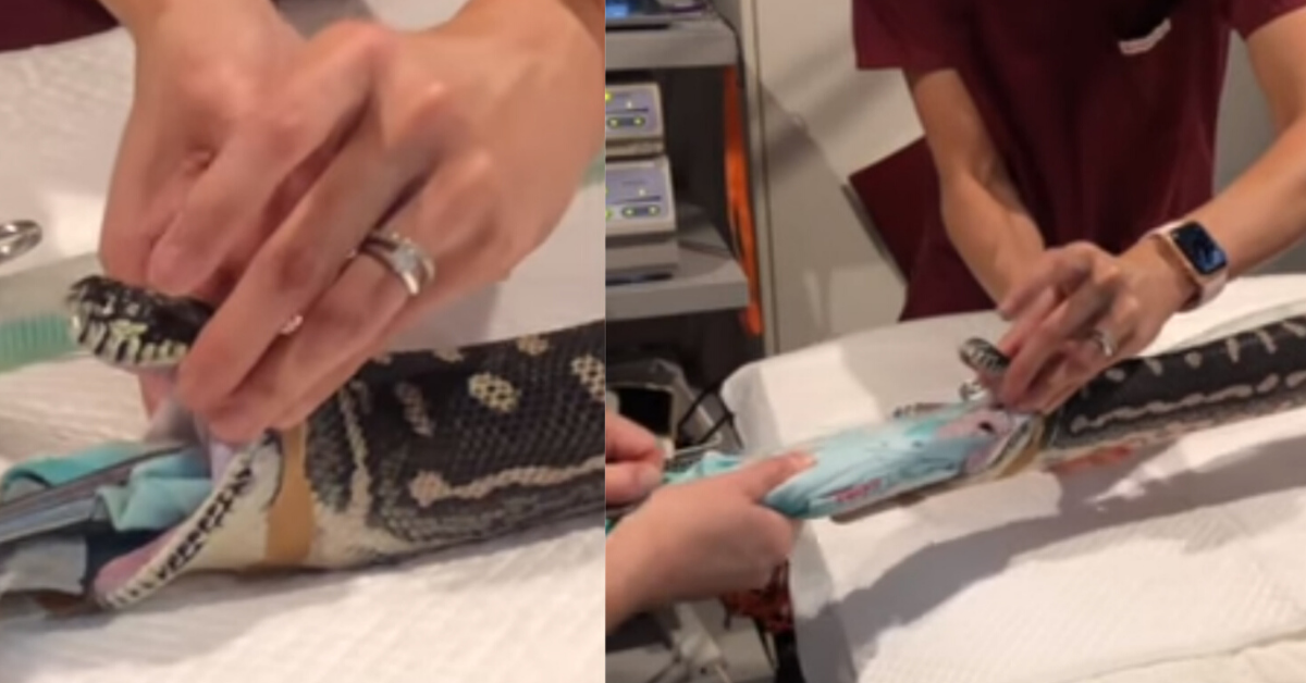 Vet Saves 18-Year-Old Snake's Life In Viral Video After It Ate An Entire Beach Towel