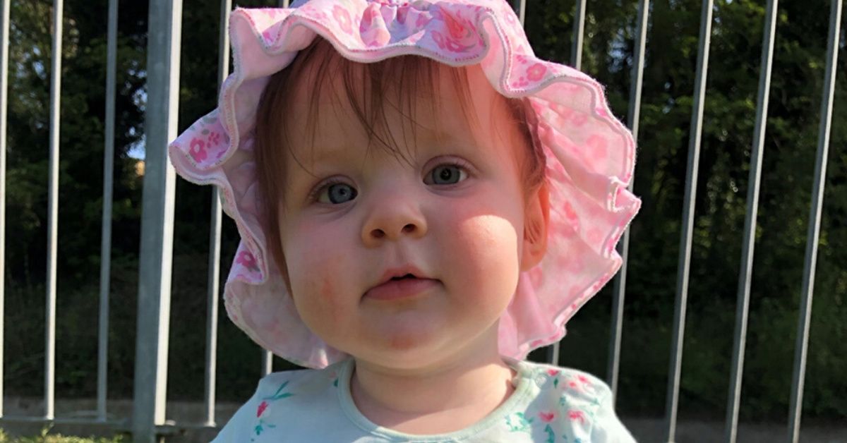 Baby Girl Who Lost An Eye After Camera Flash Exposed Rare Condition Celebrates Her First Birthday