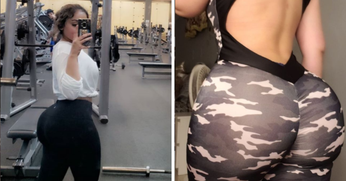 Instagram Model Whose Butt Lift Was Botched Says She Was Unable To Sit For Six Months