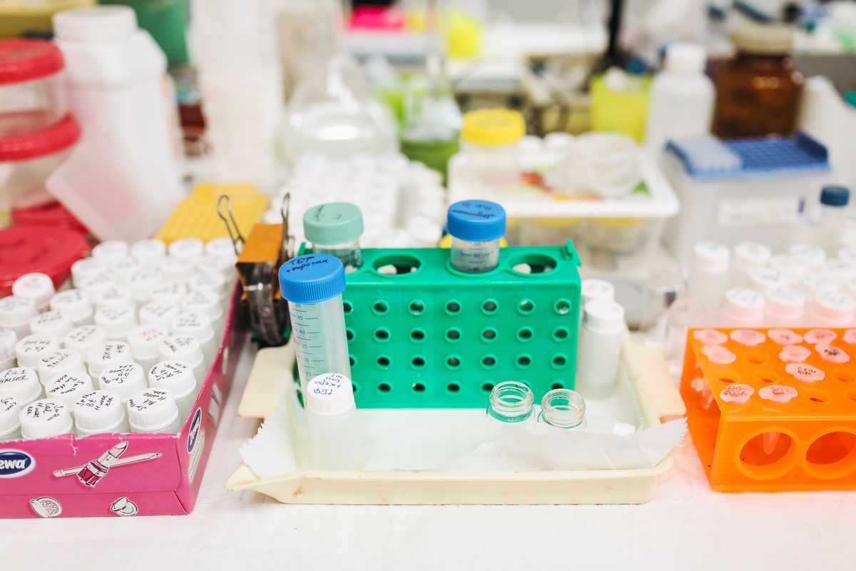 lab test tubes covid