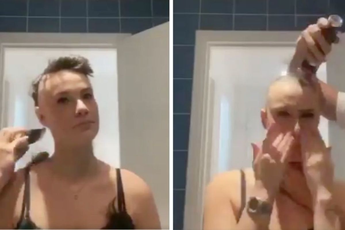 Her boyfriend gently shaved her head after her alopecia diagnosis. But what he did next is so much better.