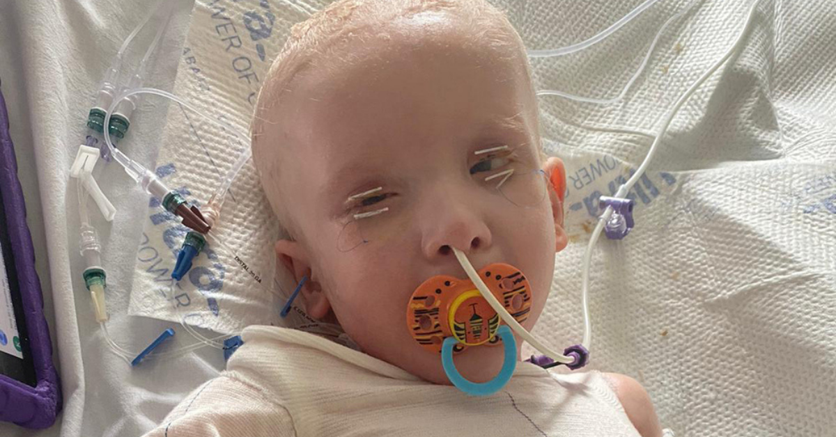 Doctors Warn Mom Her Son Might Not Survive After Rare Condition Causes His Skin To 'Slide Off'