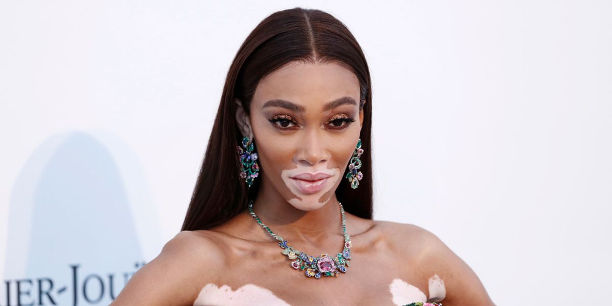 Winnie Harlow Gives Us The Details On How She Attained The Perfect Beat For Fashion Week
