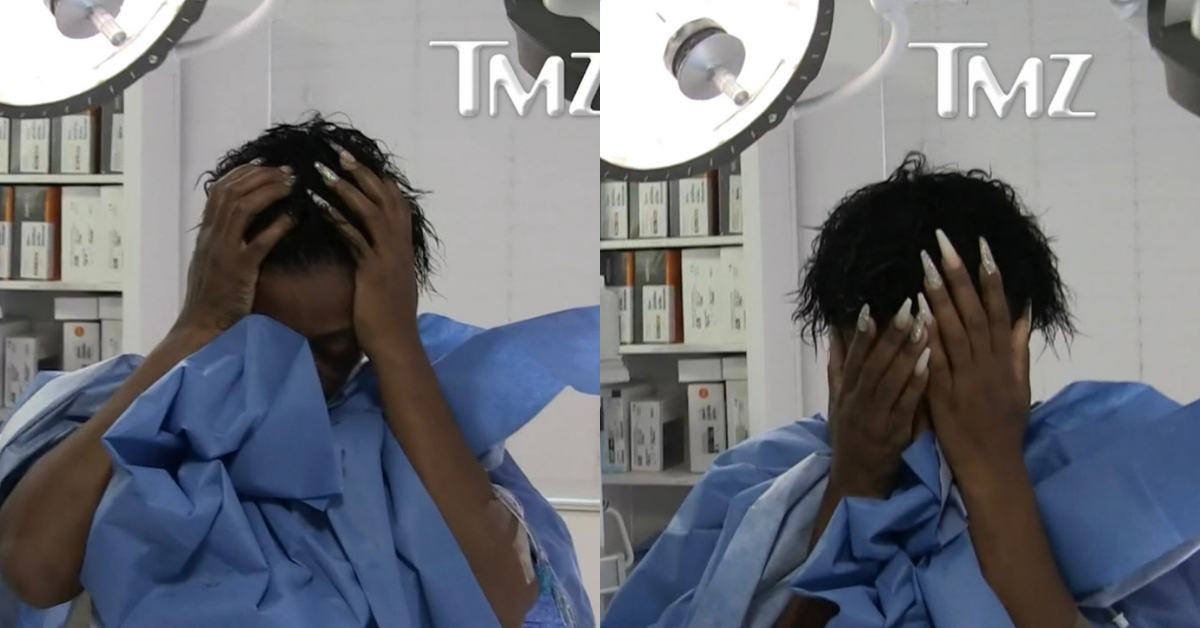 Woman Who Used Gorilla Glue On Her Hair Chokes Up After Successful 4-Hour Surgery To Remove Adhesive