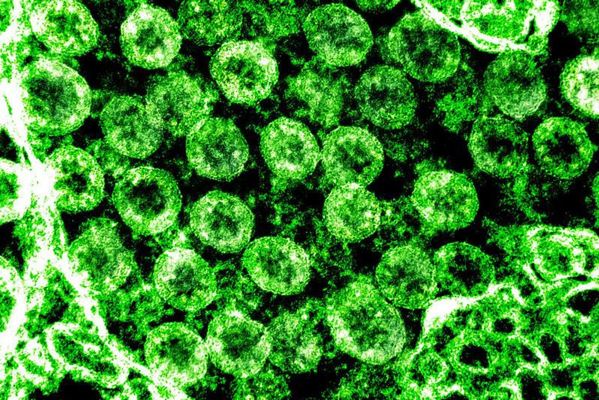 Coronavirus Update Four Zillion