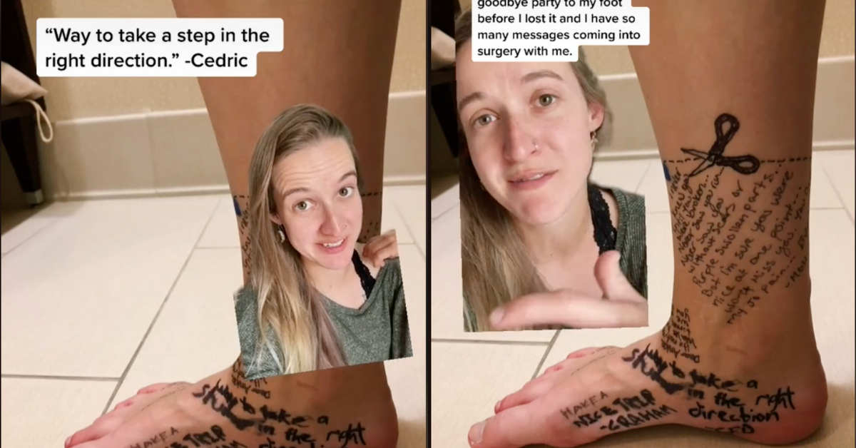 TikToker And Her Friends Write Goodbye Messages To Her Foot Before She Has It Amputated