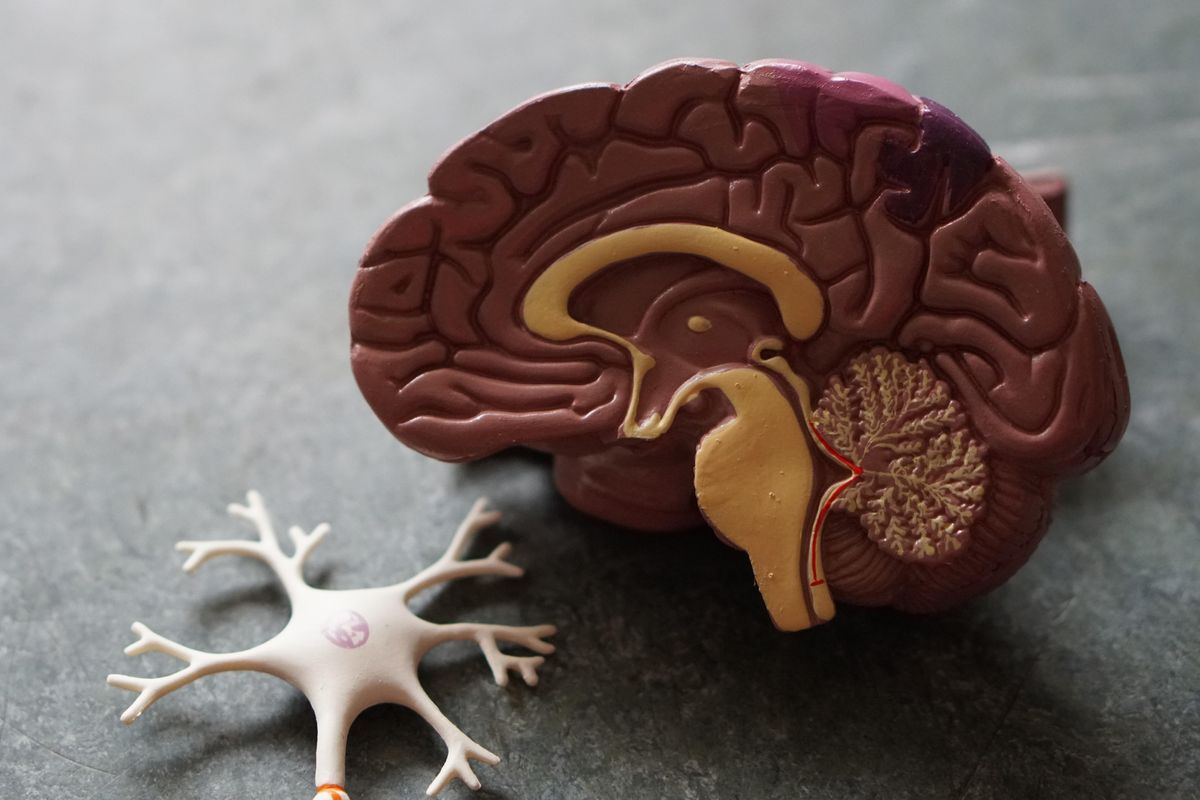 dementia; Alzheimer's; forgetfulness