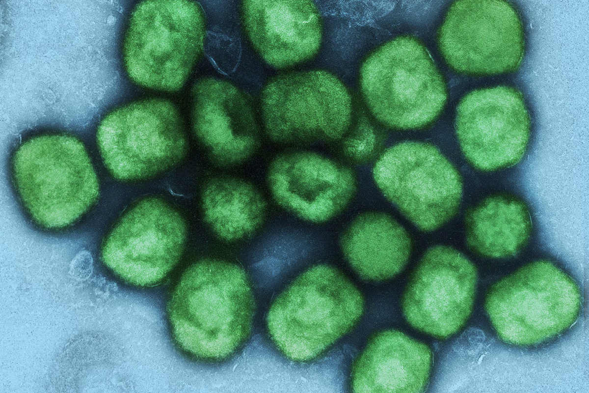 APH: First presumptive case of monkeypox identified in Travis County