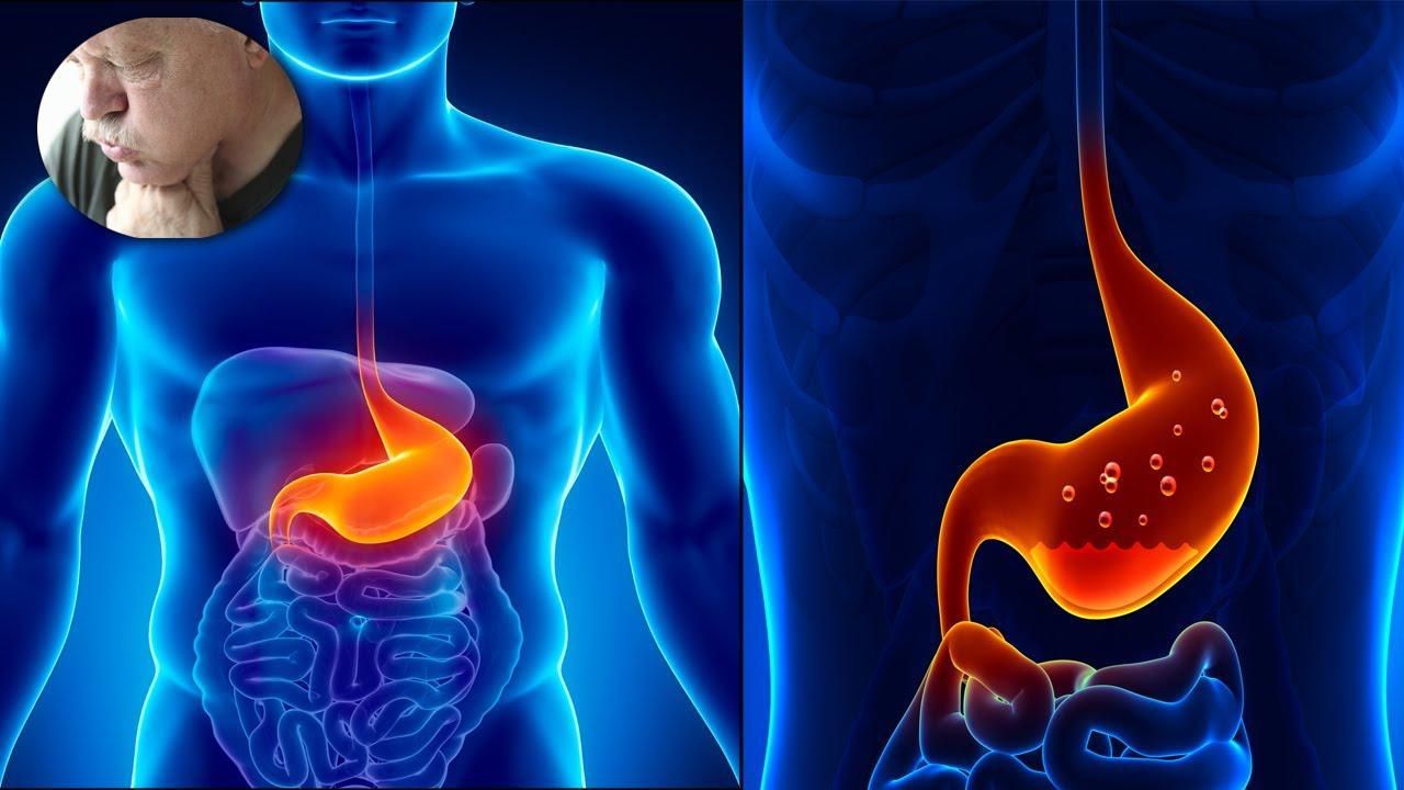 What Is Stomach Acidity?