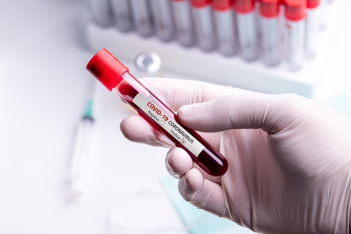 Studio choc: alterazioni nel sangue dei vaccinati