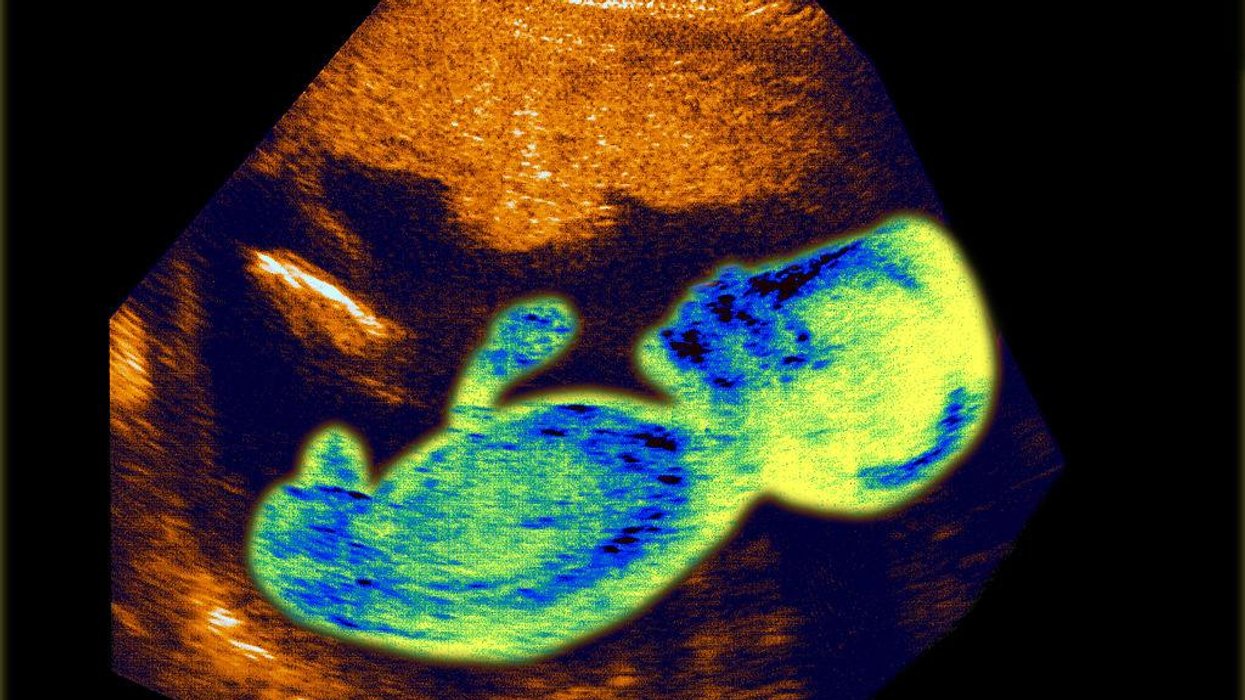 NPR airs HORRIFIC recording of woman getting abortion