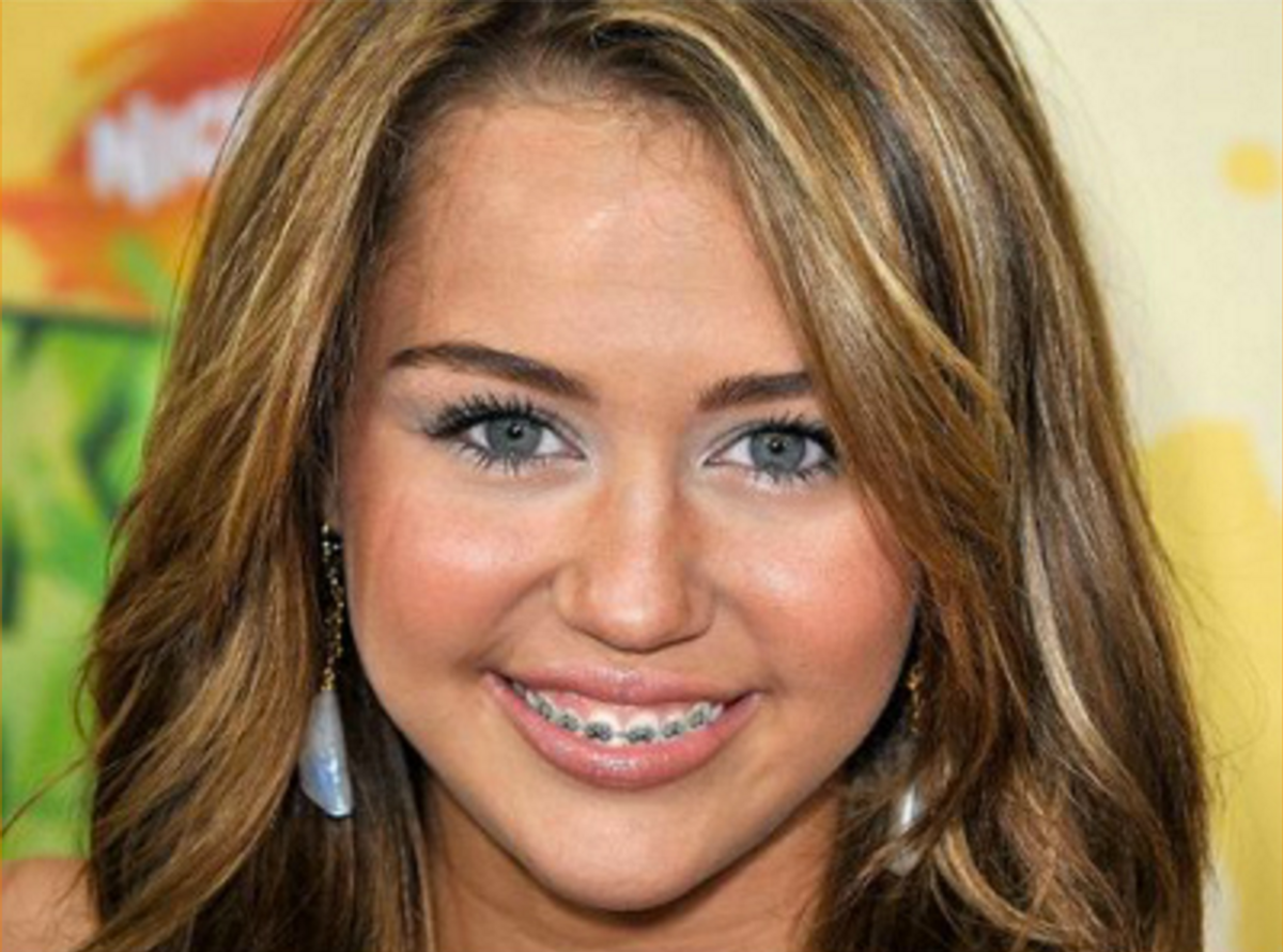 12 Struggles You'll Recall If You Ever Had Braces