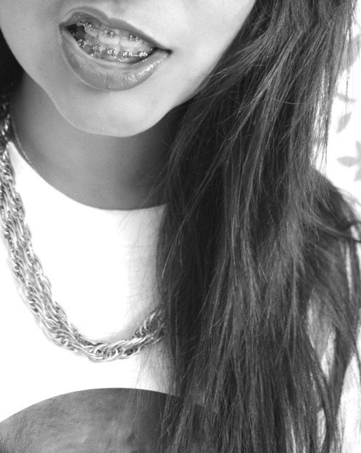 Having Braces In College A Social Experiment