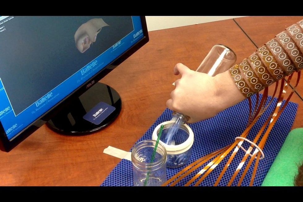 Brain Implant Lets Paralyzed Arm Move Again rbl.ms/1VnvT3J
