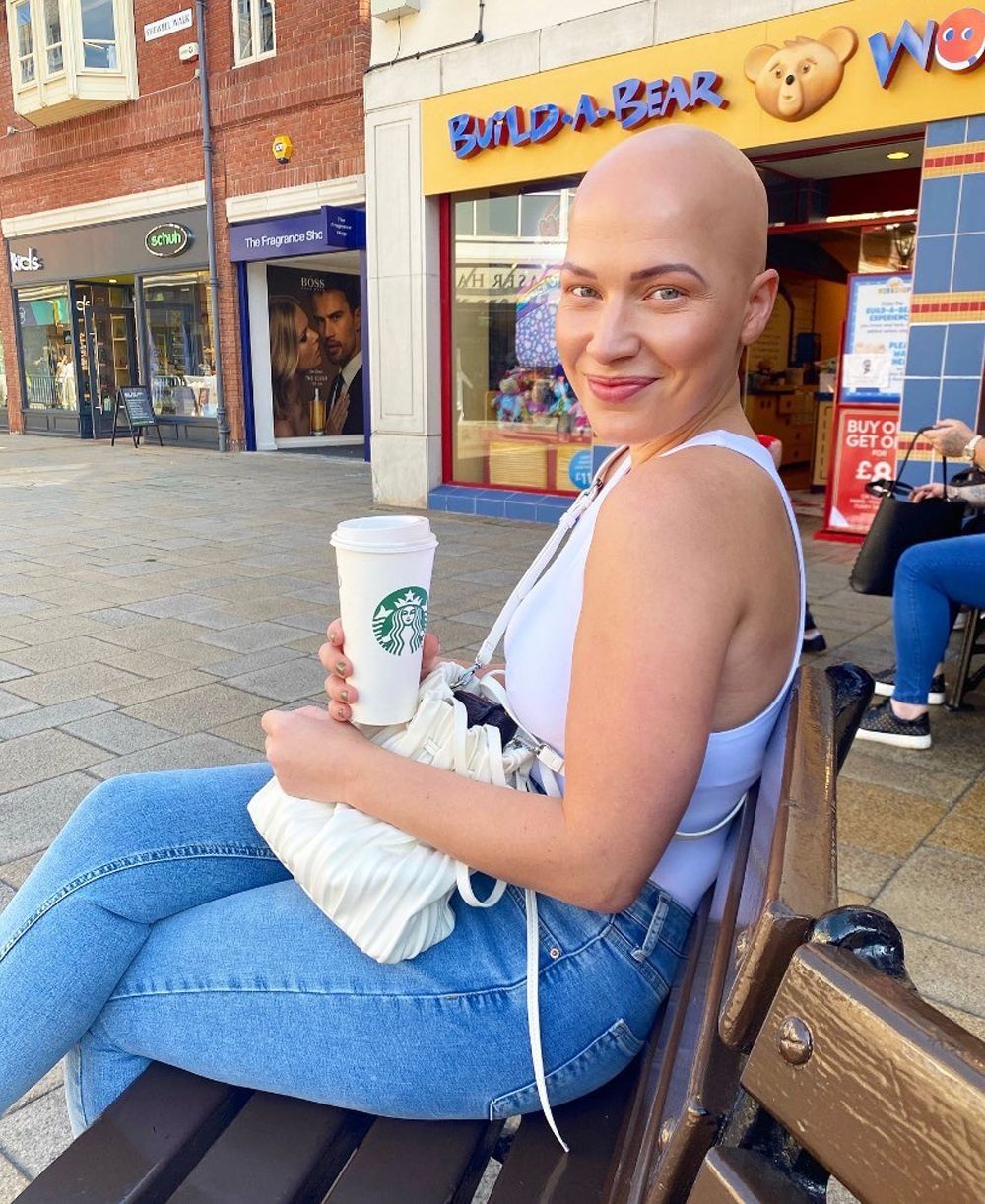 Woman With Alopecia Shows Off Bald Head On Ig Photos Comic Sands