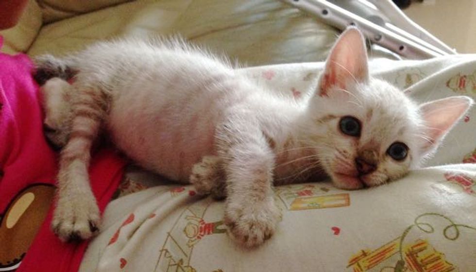 Rescue Kitten Helped Girl with Broken Leg Heal and Loves Her Like a Brother