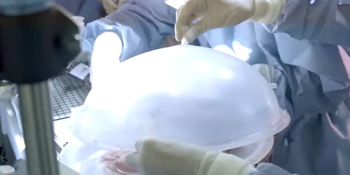 NextImg:US regulators may soon approve human trials of artificial wombs